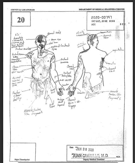 kobe bryant body sketch|Autopsies show Bryant, other passengers died。